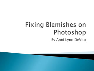 Fixing Blemishes on Photoshop By Anni Lynn DeVito 