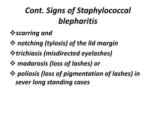 Cont. Signs of Staphylococcal
blepharitis
scarring and
 notching (tylosis) of the lid margin
trichiasis (misdirected eyelashes)
 madarosis (loss of lashes) or
 poliosis (loss of pigmentation of lashes) in
sever long standing cases
 