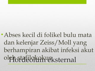 Hordeolum eksternal
•Abses kecil di folikel bulu mata
dan kelenjar Zeiss/Moll yang
berhampiran akibat infeksi akut
oleh stafilokokus
 