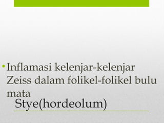 Stye(hordeolum)
•Inflamasi kelenjar-kelenjar
Zeiss dalam folikel-folikel bulu
mata
 