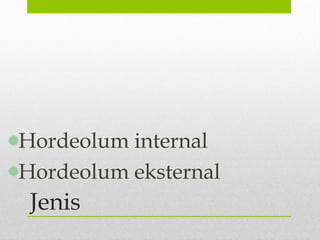 Jenis
Hordeolum internal
Hordeolum eksternal
 