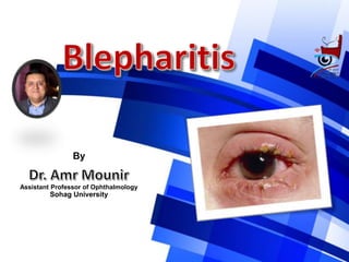 By
Assistant Professor of Ophthalmology
Sohag University
 
