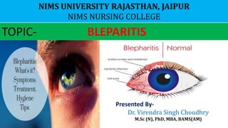 NIMS UNIVERSITY RAJASTHAN, JAIPUR
NIMS NURSING COLLEGE
TOPIC- BLEPARITIS
Presented By-
Dr. Virendra Singh Choudhry
M.Sc (N), PhD, MBA, BAMS(AM)
 