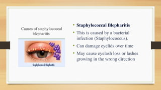 Causes of staphylococcal
blepharitis
• Staphylococcal Blepharitis
• This is caused by a bacterial
infection (Staphylococcus).
• Can damage eyelids over time
• May cause eyelash loss or lashes
growing in the wrong direction
 