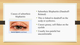 Causes of seborrheic
blepharitis
• Seborrheic Blepharitis (Dandruff-
Related)
• This is linked to dandruff on the
scalp or eyebrows.
• Causes greasy, soft flakes on the
eyelids
• Usually less painful but
uncomfortable
 
