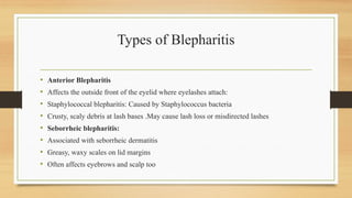 Types of Blepharitis
• Anterior Blepharitis
• Affects the outside front of the eyelid where eyelashes attach:
• Staphylococcal blepharitis: Caused by Staphylococcus bacteria
• Crusty, scaly debris at lash bases .May cause lash loss or misdirected lashes
• Seborrheic blepharitis:
• Associated with seborrheic dermatitis
• Greasy, waxy scales on lid margins
• Often affects eyebrows and scalp too
 