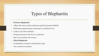 Types of Blepharitis
• Posterior Blepharitis
• Affects the inner eyelid (meibomian gland dysfunction/MGD):
• Meibomian glands produce abnormal or insufficient oils
• Leads to tear film instability
• Strong association with dry eye syndrome
• May be associated with rosacea
• Mixed Blepharitis
• Combination of anterior and posterior types
• Very common in practice
 