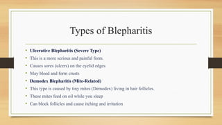 Types of Blepharitis
• Ulcerative Blepharitis (Severe Type)
• This is a more serious and painful form.
• Causes sores (ulcers) on the eyelid edges
• May bleed and form crusts
• Demodex Blepharitis (Mite-Related)
• This type is caused by tiny mites (Demodex) living in hair follicles.
• These mites feed on oil while you sleep
• Can block follicles and cause itching and irritation
 