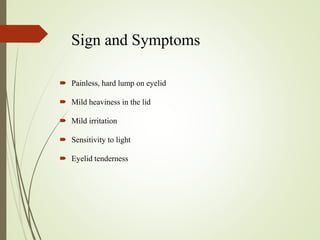 Sign and Symptoms
 Painless, hard lump on eyelid
 Mild heaviness in the lid
 Mild irritation
 Sensitivity to light
 Eyelid tenderness
 