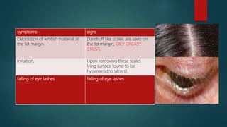 symptoms signs
Deposition of whitish material at
the lid margin
Dandruff like scales are seen on
the lid margin, OILY GREASY
CRUST,
Irritation, Upon removing these scales
lying surface found to be
hyperemic(no ulcers)
falling of eye lashes falling of eye lashes
 