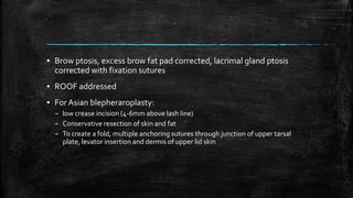 ▪ Brow ptosis, excess brow fat pad corrected, lacrimal gland ptosis
corrected with fixation sutures
▪ ROOF addressed
▪ For Asian blepheraroplasty:
– low crease incision (4-6mm above lash line)
– Conservative resection of skin and fat
– To create a fold, multiple anchoring sutures through junction of upper tarsal
plate, levator insertion and dermis of upper lid skin
 