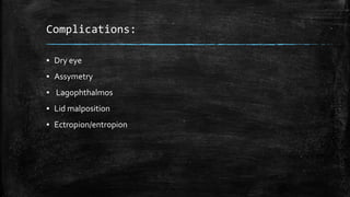 Complications:
▪ Dry eye
▪ Assymetry
▪ Lagophthalmos
▪ Lid malposition
▪ Ectropion/entropion
 