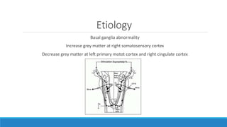 Etiology
Basal ganglia abnormality
Increase grey matter at right somatosensory cortex
Decrease grey matter at left primary motot cortex and right cingulate cortex
 