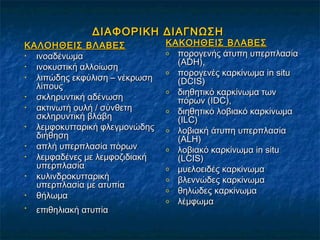 ΔΙΑΦΟΡΙΚΗ ΔΙΑΓΝΩΣΗΔΙΑΦΟΡΙΚΗ ΔΙΑΓΝΩΣΗ
ΚΑΛΟΗΘΕΙΣ ΒΛΑΒΕΣΚΑΛΟΗΘΕΙΣ ΒΛΑΒΕΣ
• ινοαδένωμαινοαδένωμα
• ινοκυστική αλλοίωσηινοκυστική αλλοίωση
• λιπώδης εκφύλιση – νέκρωσηλιπώδης εκφύλιση – νέκρωση
λίπουςλίπους
• σκληρυντική αδένωσησκληρυντική αδένωση
• ακτινωτή ουλή / σύνθετηακτινωτή ουλή / σύνθετη
σκληρυντική βλάβησκληρυντική βλάβη
• λεμφοκυτταρική φλεγμονώδηςλεμφοκυτταρική φλεγμονώδης
διήθησηδιήθηση
• απλή υπερπλασία πόρωναπλή υπερπλασία πόρων
• λεμφαδένες με λεμφοζιδιακήλεμφαδένες με λεμφοζιδιακή
υπερπλασίαυπερπλασία
• κυλινδροκυτταρικήκυλινδροκυτταρική
υπερπλασία με ατυπίαυπερπλασία με ατυπία
• θήλωμαθήλωμα
•
επιθηλιακή ατυπίαεπιθηλιακή ατυπία
ΚΑΚΟΗΘΕΙΣ ΒΛΑΒΕΣΚΑΚΟΗΘΕΙΣ ΒΛΑΒΕΣ
o πορογενής άτυπη υπερπλασίαπορογενής άτυπη υπερπλασία
((ADHADH),),
o πορογενές καρκίνωμαπορογενές καρκίνωμα in situin situ
((DCISDCIS))
o διηθητικό καρκίνωμα τωνδιηθητικό καρκίνωμα των
πόρων (πόρων (IDCIDC),),
o διηθητικό λοβιακό καρκίνωμαδιηθητικό λοβιακό καρκίνωμα
(ILC)(ILC)
o λοβιακή άτυπη υπερπλασίαλοβιακή άτυπη υπερπλασία
((ALHALH))
o λοβιακό καρκίνωμαλοβιακό καρκίνωμα in situin situ
((LCISLCIS))
o μυελοειδές καρκίνωμαμυελοειδές καρκίνωμα
o βλεννώδες καρκίνωμαβλεννώδες καρκίνωμα
o θηλώδες καρκίνωμαθηλώδες καρκίνωμα
o λέμφωμαλέμφωμα
 