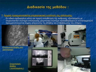 Διαδικασία της μεθόδου :Διαδικασία της μεθόδου :
1.1. Αρχικά πραγματοποιείται στερεοτακτική εντόπιση της αλλοίωσηςΑρχικά πραγματοποιείται στερεοτακτική εντόπιση της αλλοίωσης..
Σε ειδικά σχεδιασμένη κλίνη για πρηνή τοποθέτηση της ασθενούς, εξοπλισμένη μεΣε ειδικά σχεδιασμένη κλίνη για πρηνή τοποθέτηση της ασθενούς, εξοπλισμένη με
στερεοτακτικό σύστημα απεικόνισης (ρομποτικό σύστημα προκαθορισμένων συντεταγμένων)στερεοτακτικό σύστημα απεικόνισης (ρομποτικό σύστημα προκαθορισμένων συντεταγμένων)
πραγματοποιούνται λήψεις ανίχνευσης της βλάβης και επιβεβαίωσης του στόχου.πραγματοποιούνται λήψεις ανίχνευσης της βλάβης και επιβεβαίωσης του στόχου.
Επισήμανση βλάβης στη
μαστογραφία
Στοχοποίηση
βλάβης
( συντεταγμένες )
 