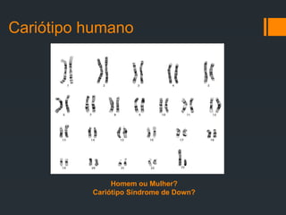 Cariótipo humano
Homem ou Mulher?
Cariótipo Síndrome de Down?
 