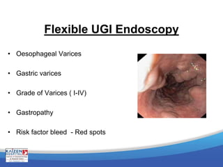 Flexible UGI Endoscopy
• Oesophageal Varices
• Gastric varices
• Grade of Varices ( I-IV)
• Gastropathy
• Risk factor bleed - Red spots
 