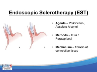 Endoscopic Sclerotherapy (EST)
• Agents – Polidocanol,
Absolute Alcohol
• Methods – Intra /
Paravariceal
• Mechanism – fibrosis of
connective tissue
 
