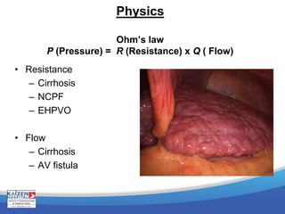 Physics
Ohm’s law
P (Pressure) = R (Resistance) x Q ( Flow)
• Resistance
– Cirrhosis
– NCPF
– EHPVO
• Flow
– Cirrhosis
– AV fistula
 