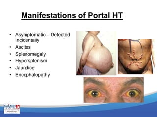 Manifestations of Portal HT
• Asymptomatic – Detected
Incidentally
• Ascites
• Splenomegaly
• Hypersplenism
• Jaundice
• Encephalopathy
 