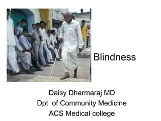 Blindness
Daisy Dharmaraj MD
Dpt of Community Medicine
ACS Medical college
 