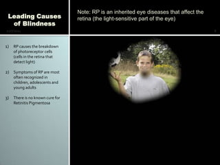 Note: RP is an inherited eye diseases that affect the
 Leading Causes                   retina (the light-sensitive part of the eye)
  of Blindness
12/7/2011                                                                                 8



1)   RP causes the breakdown
     of photoreceptor cells
     (cells in the retina that
     detect light)

2) Symptoms of RP are most
     often recognized in
     children, adolescents and
     young adults

3)   There is no known cure for
     Retinitis Pigmentosa
 