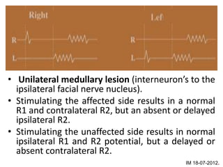 • Unilateral medullary lesion (interneuron’s to the
  ipsilateral facial nerve nucleus).
• Stimulating the affected side results in a normal
  R1 and contralateral R2, but an absent or delayed
  ipsilateral R2.
• Stimulating the unaffected side results in normal
  ipsilateral R1 and R2 potential, but a delayed or
  absent contralateral R2.
                                           IM 18-07-2012.
 