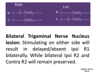 Bilateral Trigeminal Nerve Nucleus
lesion: Stimulating on either side will
result in delayed/absent Ipsi R1
bilaterally. While bilateral Ipsi R2 and
Contra R2 will remain preserved.
                                   IM/EK 18-07-
                                      2012.
 