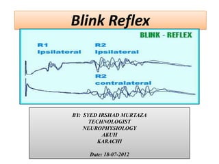 Blink Reflex




BY: SYED IRSHAD MURTAZA
      TECHNOLOGIST
    NEUROPHYSIOLOGY
          AKUH
         KARACHI

     Date: 18-07-2012
 
