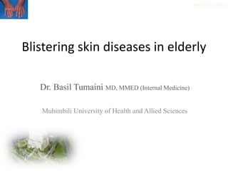Basil Tumaini
Blistering skin diseases in elderly
Dr. Basil Tumaini MD, MMED (Internal Medicine)
Muhimbili University of Health and Allied Sciences
 