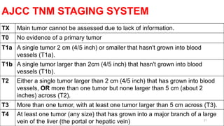 AJCC TNM STAGING SYSTEM
21
TX Main tumor cannot be assessed due to lack of information.
T0 No evidence of a primary tumor
T1a A single tumor 2 cm (4/5 inch) or smaller that hasn't grown into blood
vessels (T1a).
T1b A single tumor larger than 2cm (4/5 inch) that hasn't grown into blood
vessels (T1b).
T2 Either a single tumor larger than 2 cm (4/5 inch) that has grown into blood
vessels, OR more than one tumor but none larger than 5 cm (about 2
inches) across (T2).
T3 More than one tumor, with at least one tumor larger than 5 cm across (T3).
T4 At least one tumor (any size) that has grown into a major branch of a large
vein of the liver (the portal or hepatic vein)
 