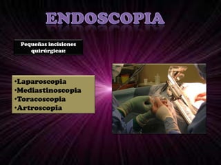 DuodenoEndoscopiaSegún el orificio:Por ano hasta ciegoEndoscopia digestiva BajaRecto