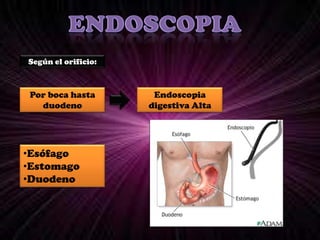 Poca molestiaRiesgosDolor