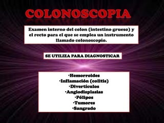 InfecciónEnteroscopiaPanendoscopiaEndoscopiaColonoscopiaColangiopancreatografía retrógrada endoscópica