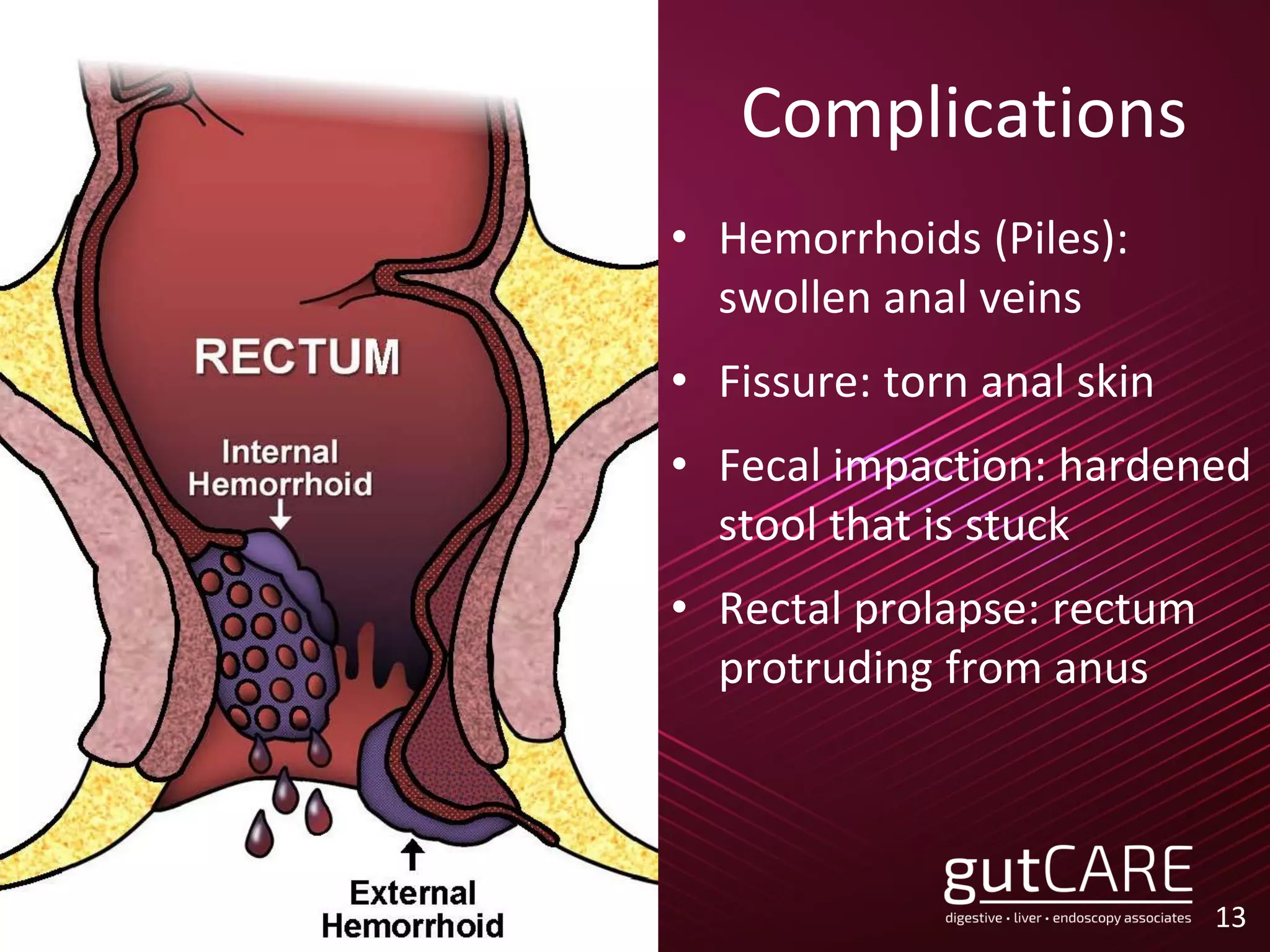 Complications
• Hemorrhoids (Piles):
swollen anal veins
• Fissure: torn anal skin
• Fecal impaction: hardened
stool that is stuck
• Rectal prolapse: rectum
protruding from anus
13
 