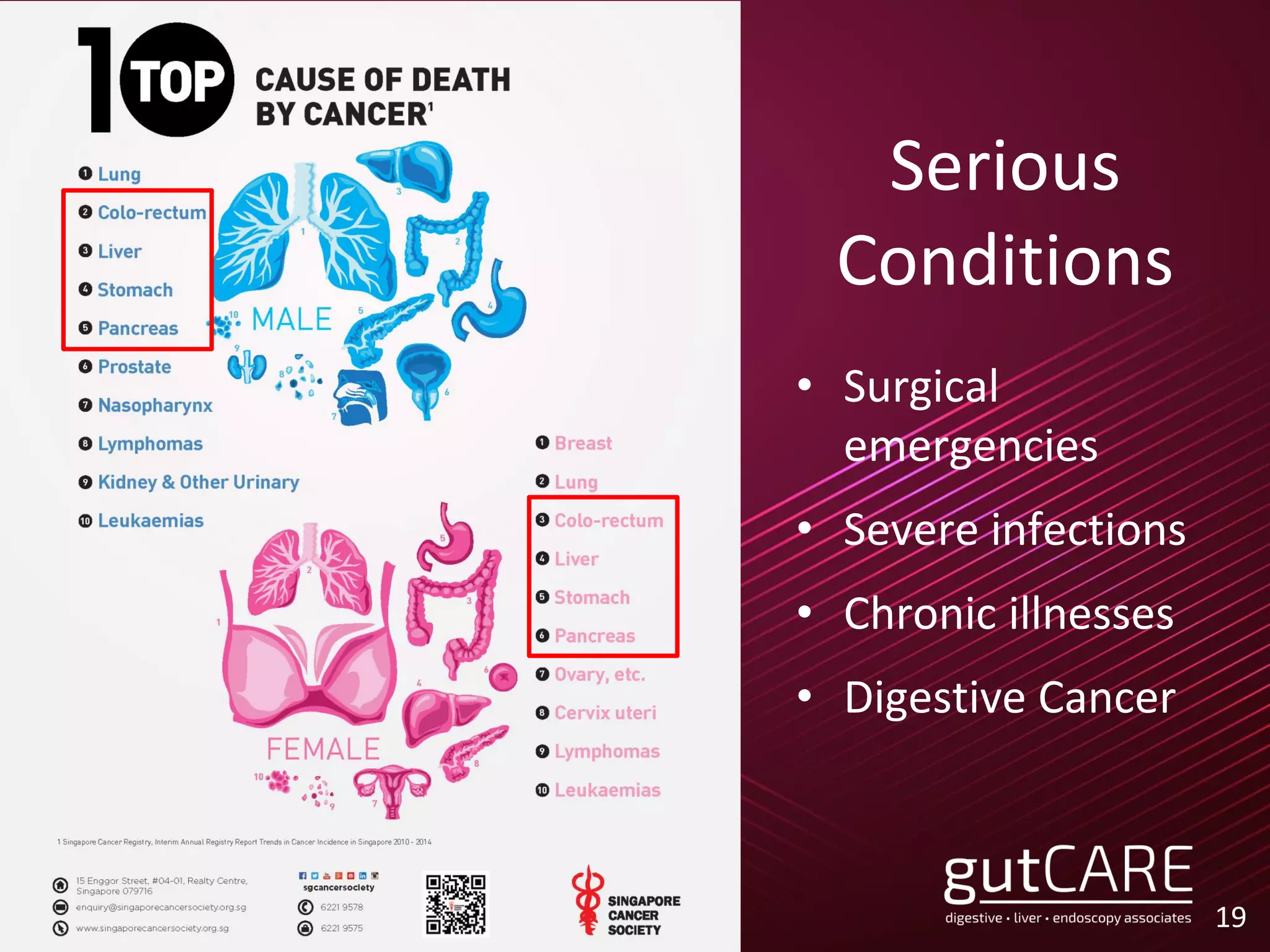 Serious
Conditions
• Surgical
emergencies
• Severe infections
• Chronic illnesses
• Digestive Cancer
19
 