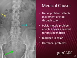 Medical Causes
12
• Nerve problem: affects
movement of stool
through colon
• Pelvic muscle problem:
affects muscles needed
for passing motion
• Blockage in colon
• Hormonal problems
 