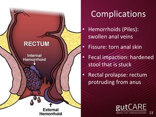 Complications
• Hemorrhoids (Piles):
swollen anal veins
• Fissure: torn anal skin
• Fecal impaction: hardened
stool that is stuck
• Rectal prolapse: rectum
protruding from anus
13
 