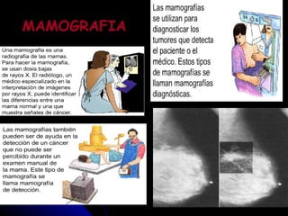 MAMOGRAFIA 