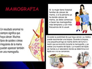 MAMOGRAFIA 