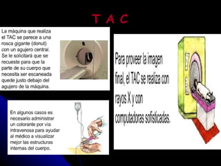 T A C 
