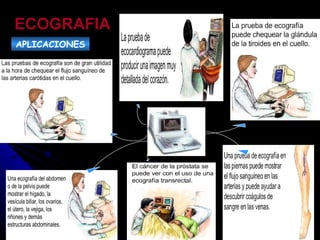 ECOGRAFIA APLICACIONES 