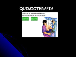 QUIMIOTERAPIA 
