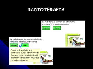 RADIOTERAPIA 