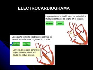 ELECTROCARDIOGRAMA 
