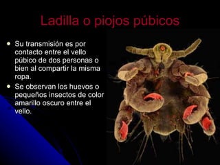 Ladilla o piojos púbicos Su transmisión es por contacto entre el vello púbico de dos personas o bien al compartir la misma ropa. Se observan los huevos o pequeños insectos de color amarillo oscuro entre el vello. 