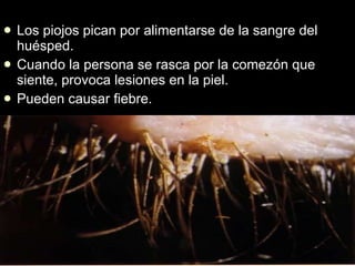 Los piojos pican por alimentarse de la sangre del huésped. Cuando la persona se rasca por la comezón que siente, provoca lesiones en la piel. Pueden causar fiebre. 