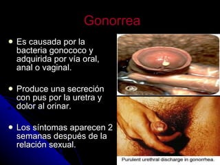 Gonorrea Es causada por la bacteria gonococo y adquirida por vía oral, anal o vaginal. Produce una secreción con pus por la uretra y dolor al orinar. Los síntomas aparecen 2 semanas después de la relación sexual.                         