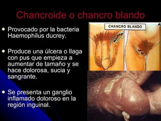 Chancroide o chancro blando Provocado por la bacteria Haemophilus ducrey. Produce una úlcera o llaga con pus que empieza a aumentar de tamaño y se hace dolorosa, sucia y sangrante. Se presenta un ganglio inflamado doloroso en la región inguinal. 