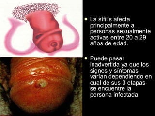 La sífilis afecta principalmente a personas sexualmente activas entre 20 a 29 años de edad. Puede pasar inadvertida ya que los signos y síntomas varían dependiendo en cual de sus 3 etapas se encuentre la persona infectada:  